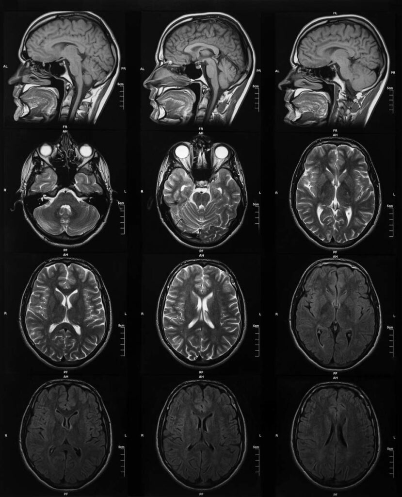 Softboiled Egg and Perfectly Steamed Rice Philippines Graphic